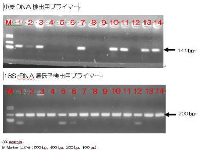 DS-PF泳動